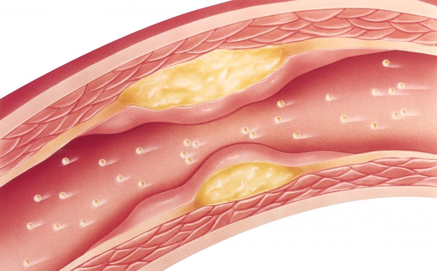 Además de ayudar a controlar el colesterol la niacina beneficia la salud de la piel y del aparato digestivo