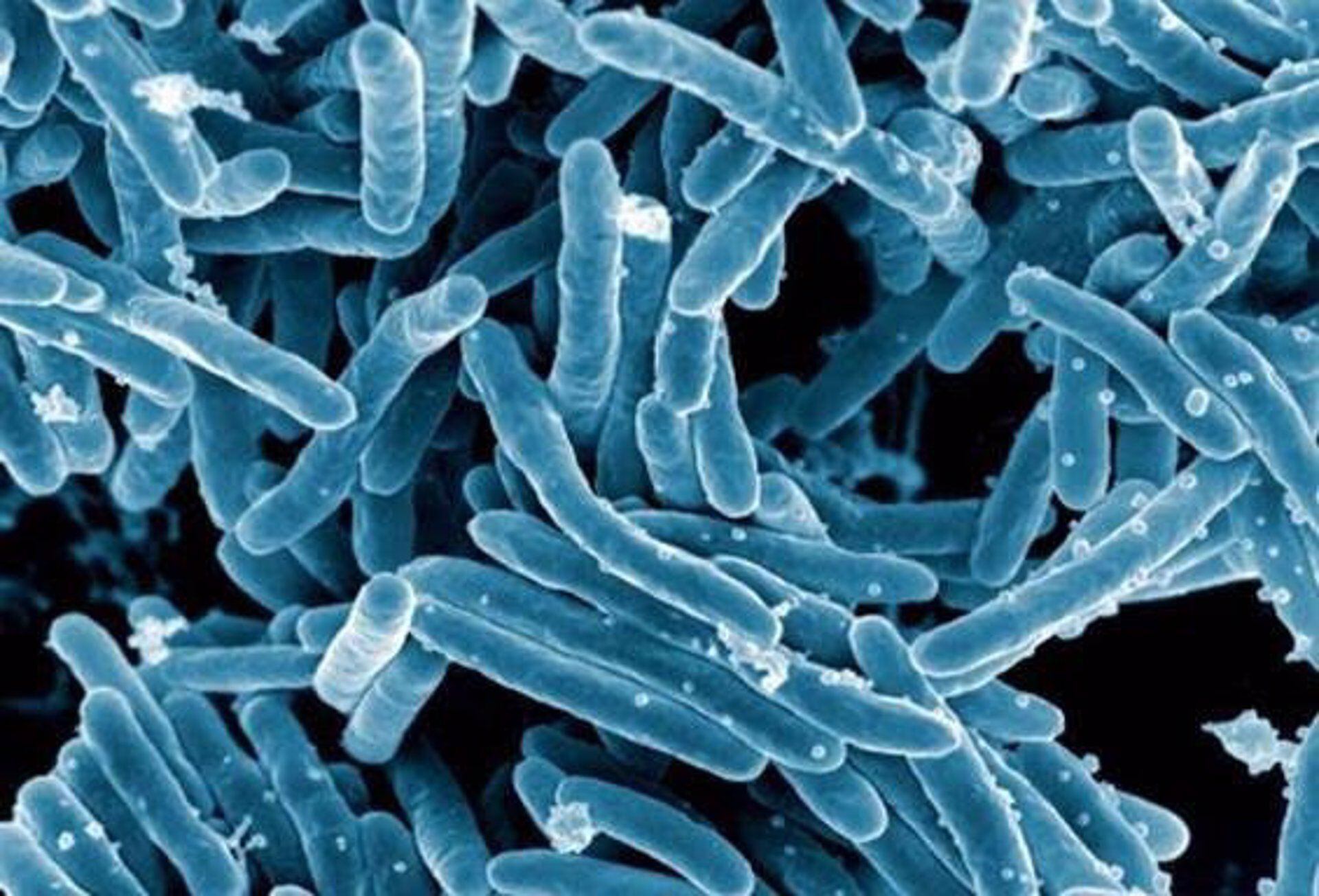 La tasa de incidencia de la tuberculosis en España cae cerca de dos puntos en tres años, según Sanidad