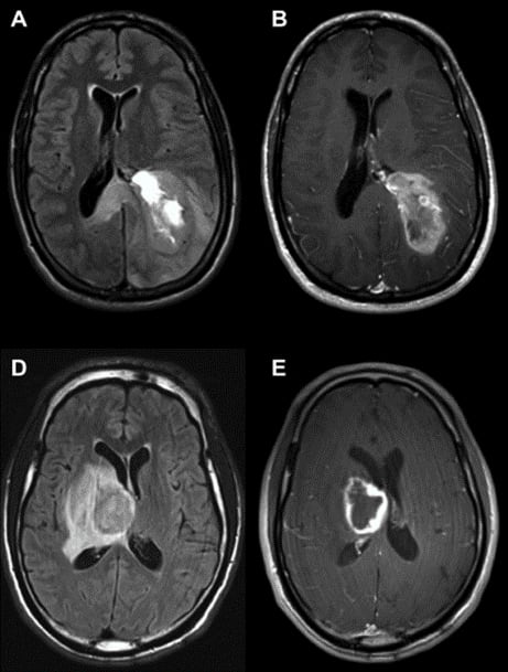 Crédito: Gentileza, neurocirujano, Franco Rubino