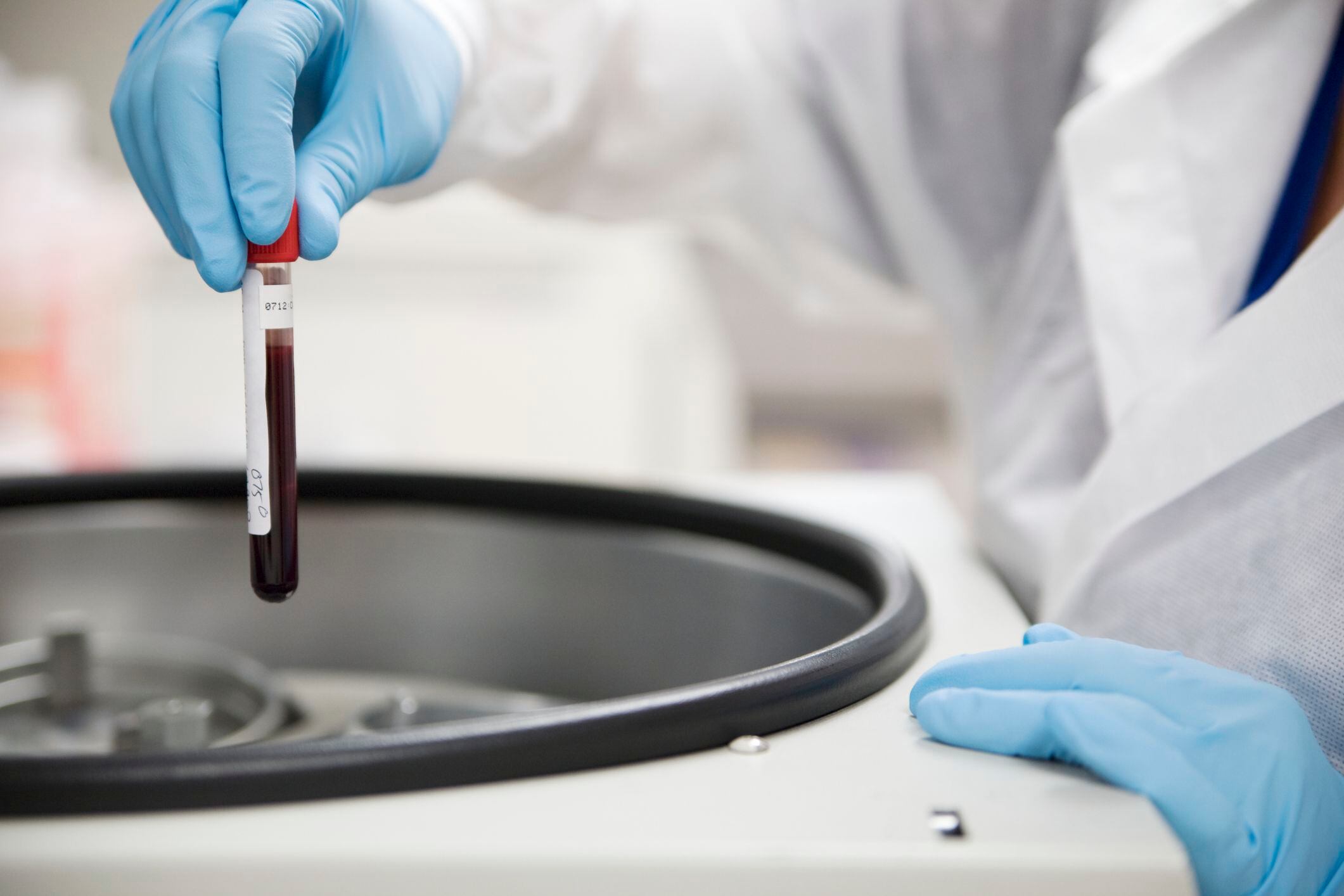 Un técnico de laboratorio que inserta un tubo de ensayo de muestra de sangre en una centrífuga (GETTY IMAGE)