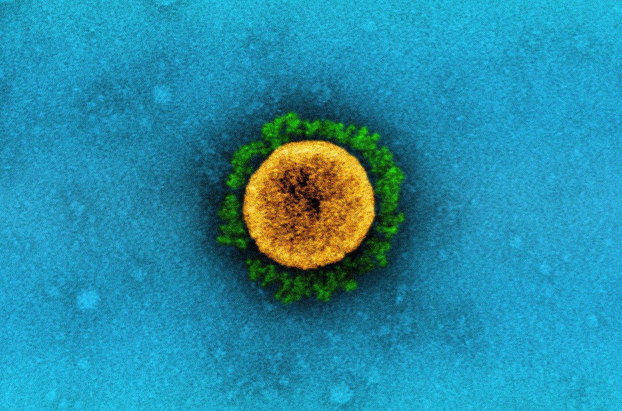 SARS-CoV-2 virus COVID Getty Images