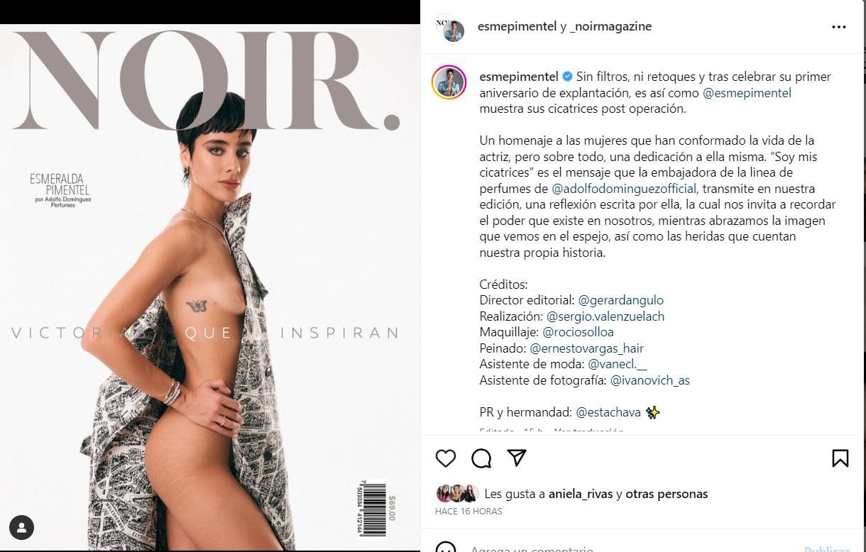 Esmeralda Pimentel se mostró sin filtros y orgullosa de sus estrías: “Soy  mis cicatrices” - Infobae