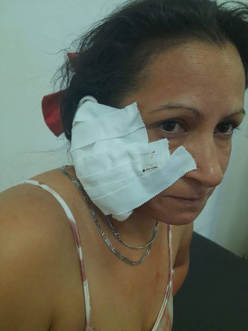 Violencia de género en Avellaneda: un hombre le arrancó un pedazo de oreja a su novia