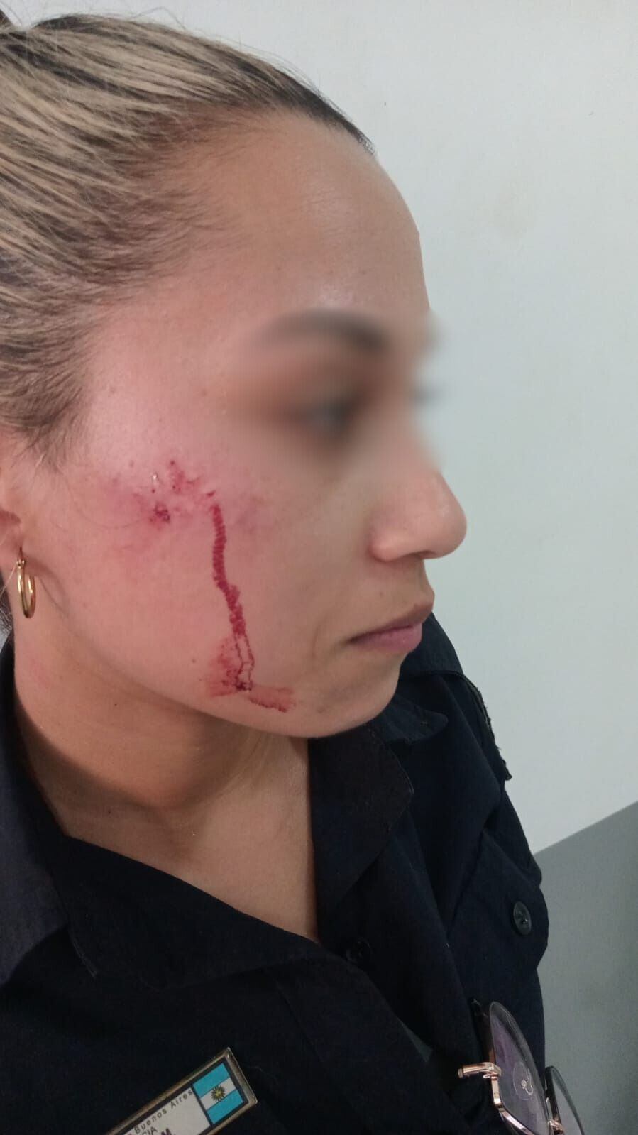 la oficial de policía Mariana Elisabeth Avalos herida en un procedimiento en La Plata