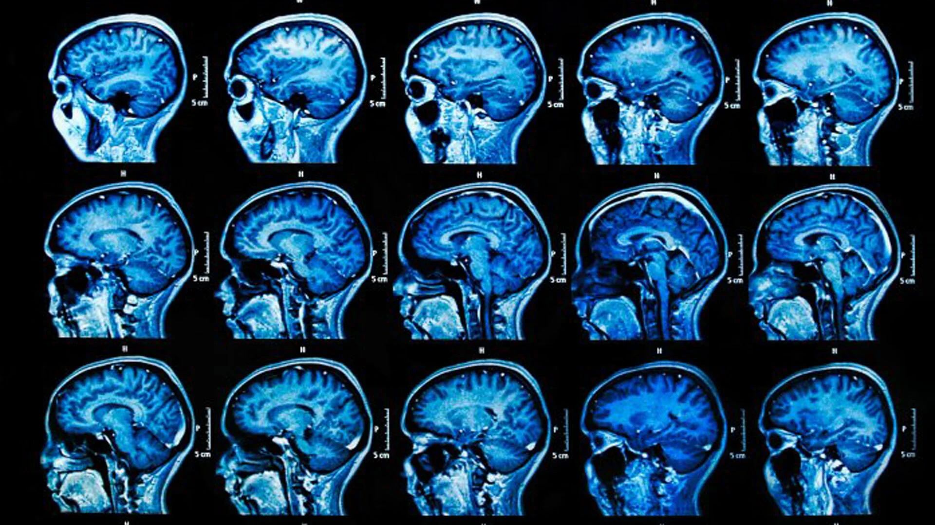 Estudios científicos corroboran cómo se compromenten las neuronas (iStock)