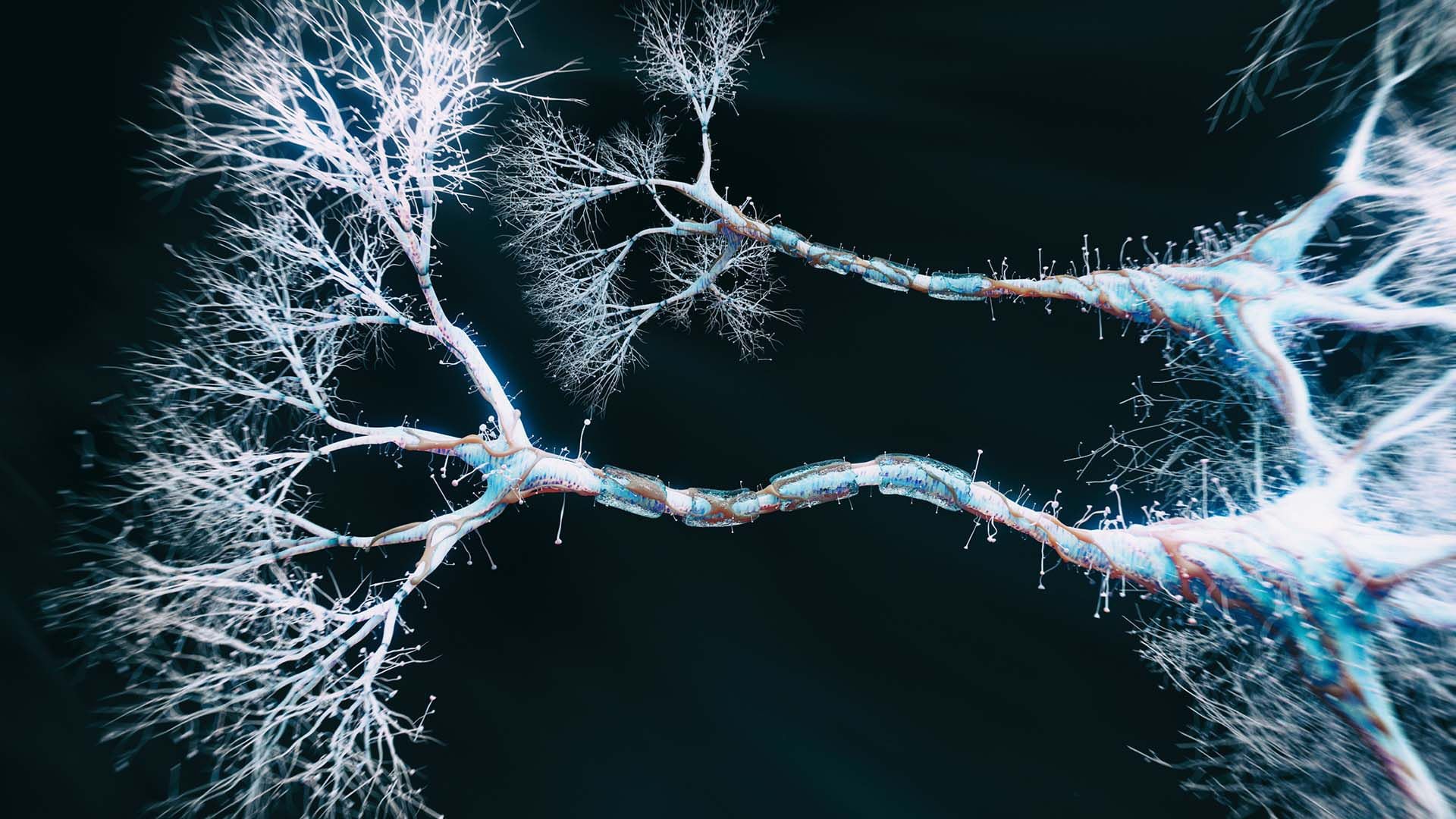 La edad afecta a la mielina y aumenta el riesgo de Alzheimer