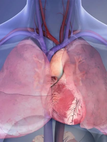 La SAL NATURAL SIN REFINAR podría evitarte un ataque cardíaco