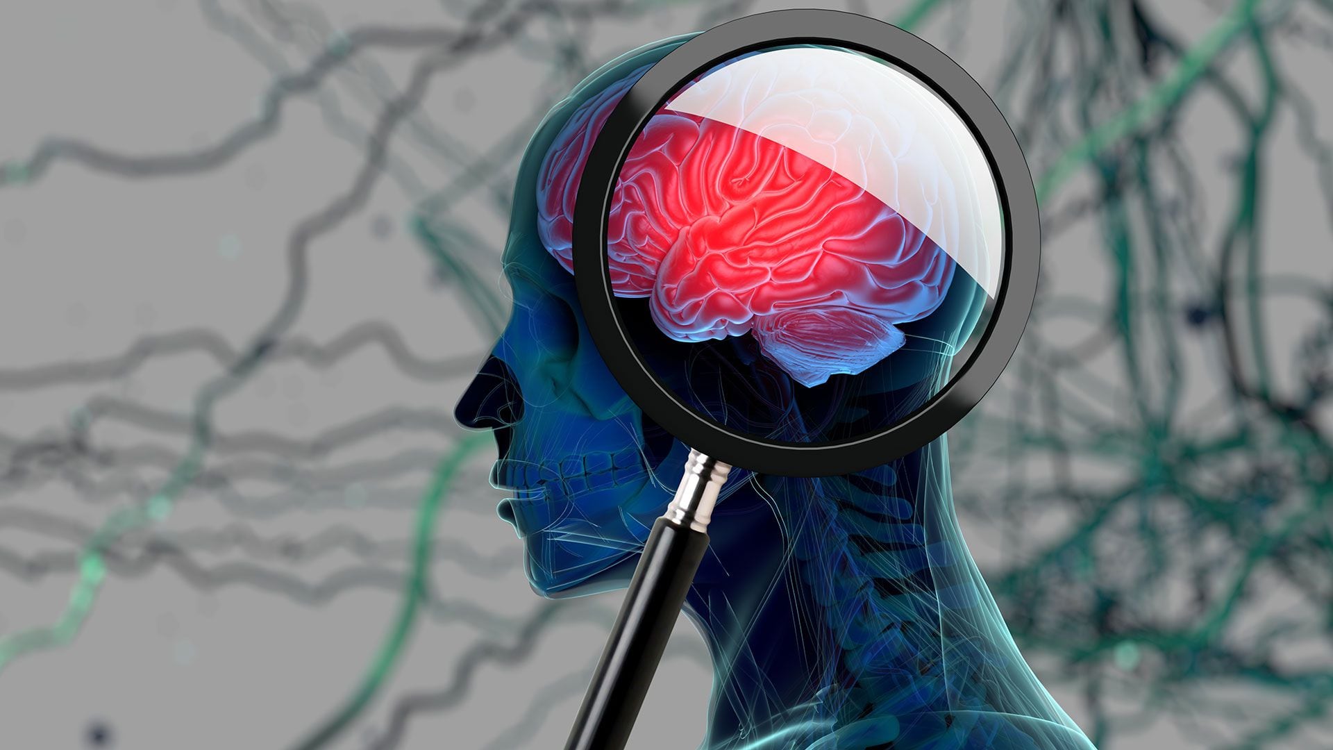 La terapia de estimulación cerebral bloquea las señales que causan los síntomas motores (Getty)