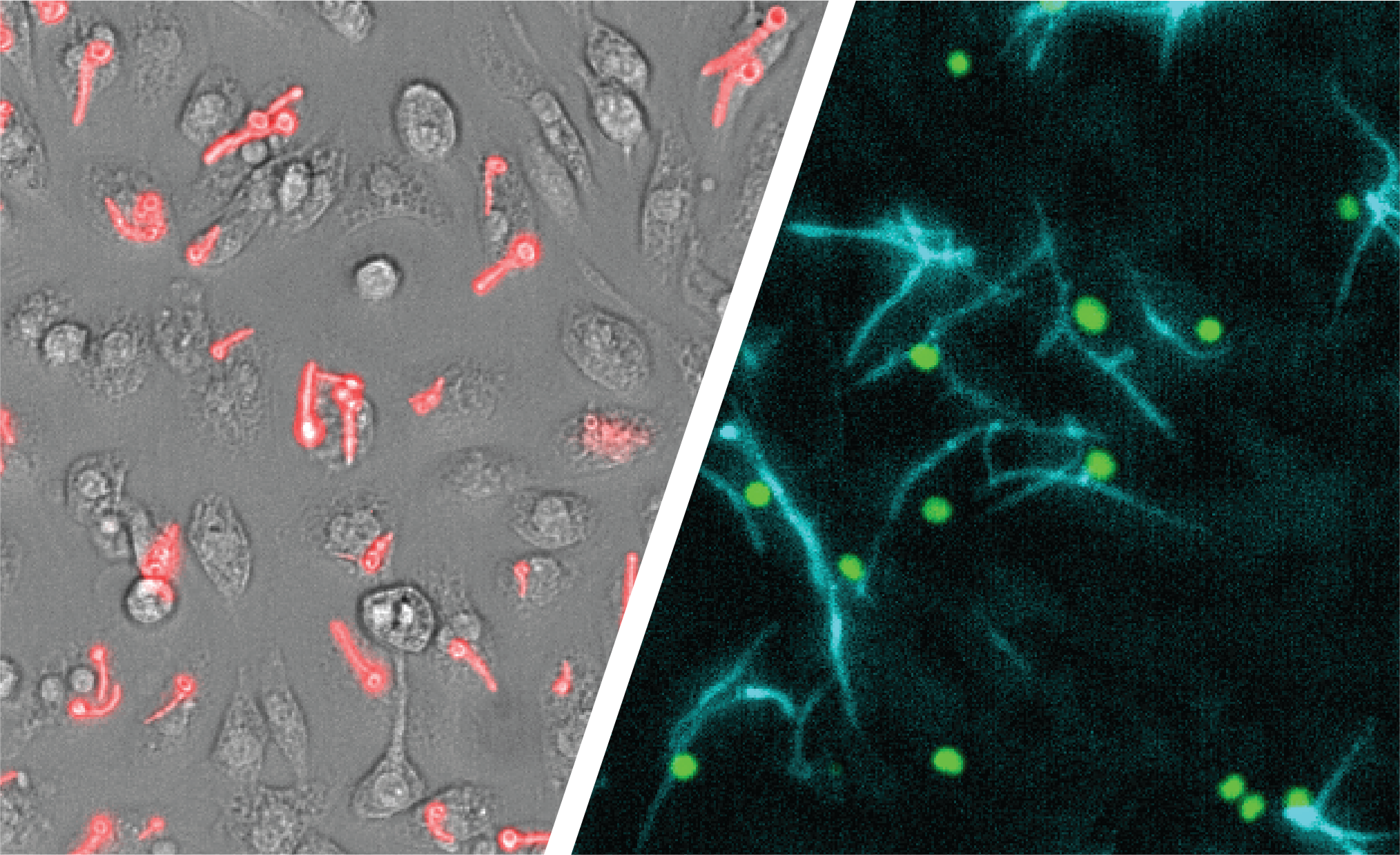 Candida albicans es un hongo común que se ha detectado en el cerebro de personas con enfermedad de Alzheimer y otros trastornos neurodegenerativos crónicos