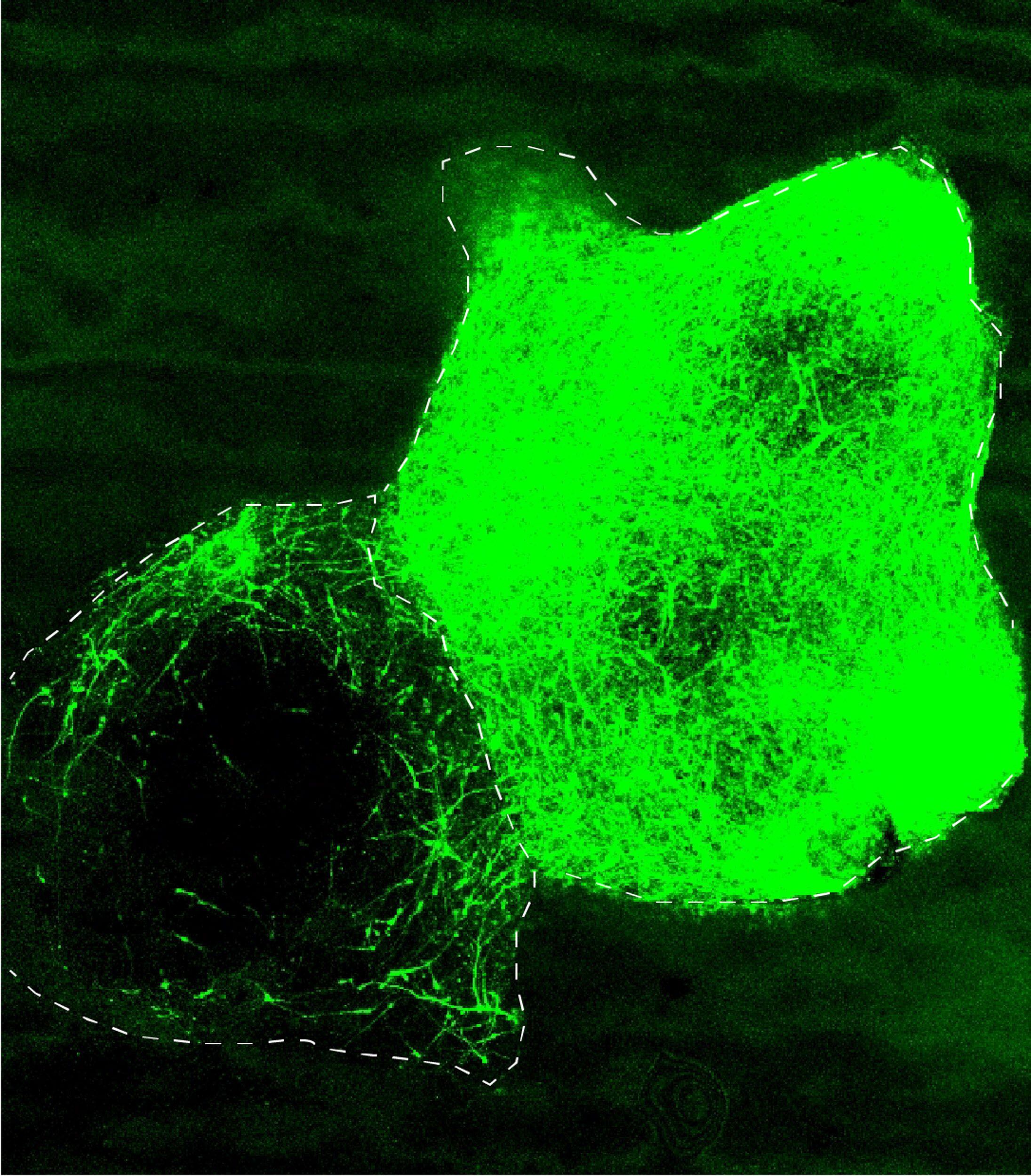 Grupos de células en una placa de laboratorio, con las neuronas mostradas en verde. (Sergiu P. Pasca)