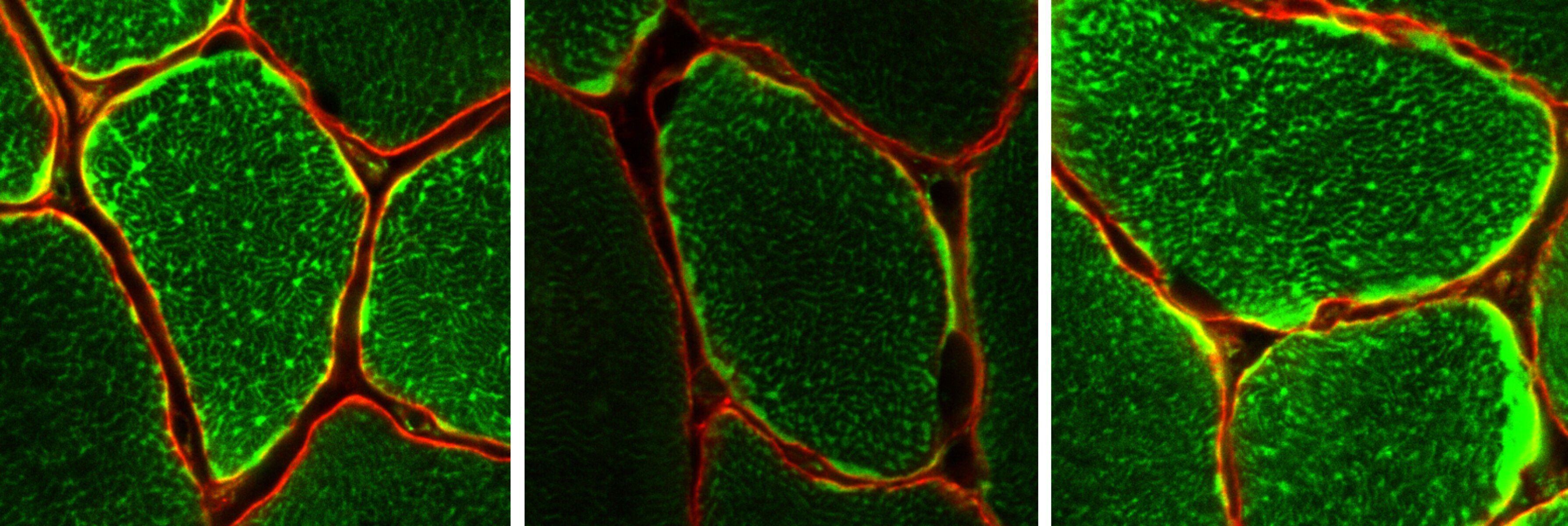 En la imagen, tinción que muestra las mitocondrias dentro de las fibras musculares individuales (EFE/Universidad de Monash)
