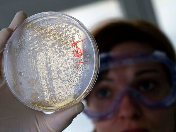 Los científicos saben que la bacteria Escherichia coli que puede ser relativamente inofensiva en el colon. Sin embargo, puede ser dañina al causar una infección urinaria si invade la uretra/Archivo