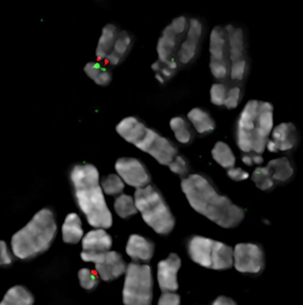 CAPTION A set of human chromosomes with the "primary" and "backup" sites for centromere assembly on chromosome 17 painted in red and green, respectively.  CREDIT Elizabeth Sullivan, Duke University