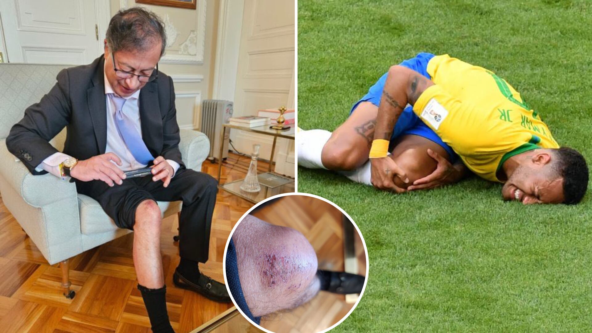 El presidente Gustavo Petro y el futbolista Neymar siguen siendo objeto de comparaciones, ya que ambos se lesionaron y tuvieron que retirarse de sus trabajos - crédito @josedavilachar - @petrogustavo/X - AFP