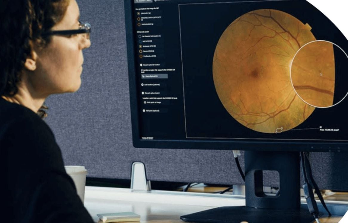 Os telefones celulares podem ajudar o profissional de saúde a avaliar a saúde ocular de seus pacientes (Google)