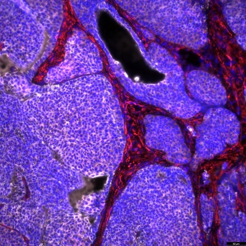 Cáncer de mama en ratón, con células tumorales en color blanco (Europa Press) 