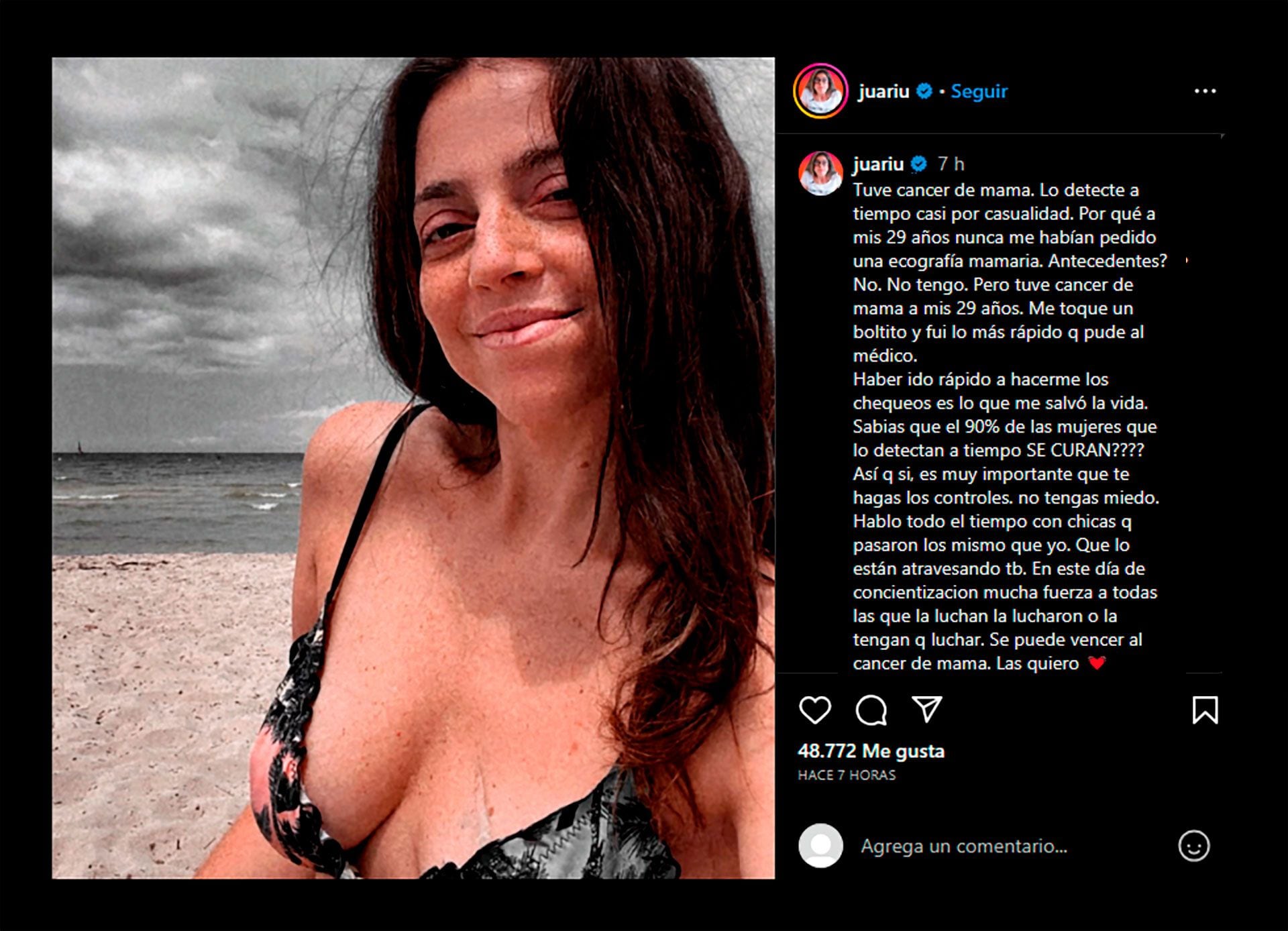 Juariu reveló cómo superó el cáncer de mama (Instagram)