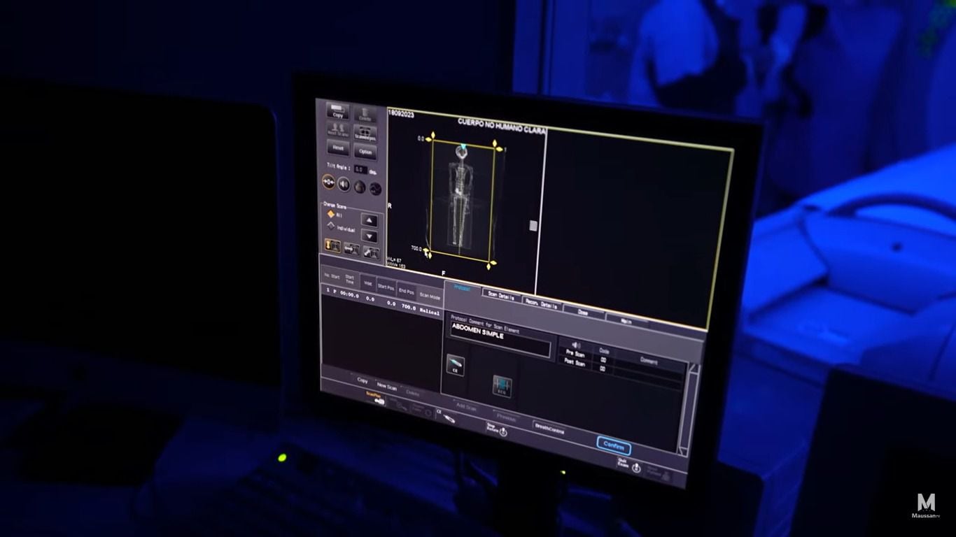 Se realizaron tomografías y rayos x a cuerpos extraterrestres (Crédito: YouTube/MaussanTV)