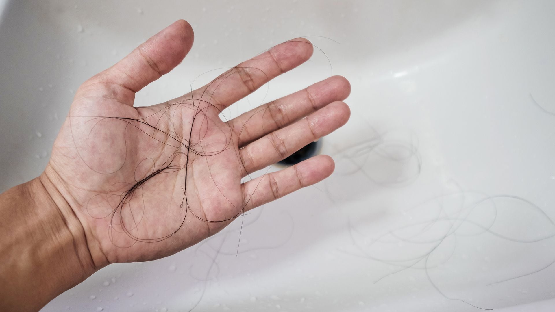 La pérdida del cabello es una preocupación frecuente que afecta a millones de personas en todo el mundo/ Archivo Infobae 