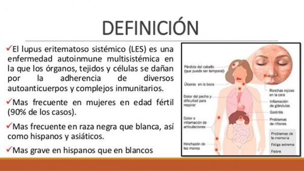 Ultimos Avances en Ciencia y Salud - Página 14 Lupus4