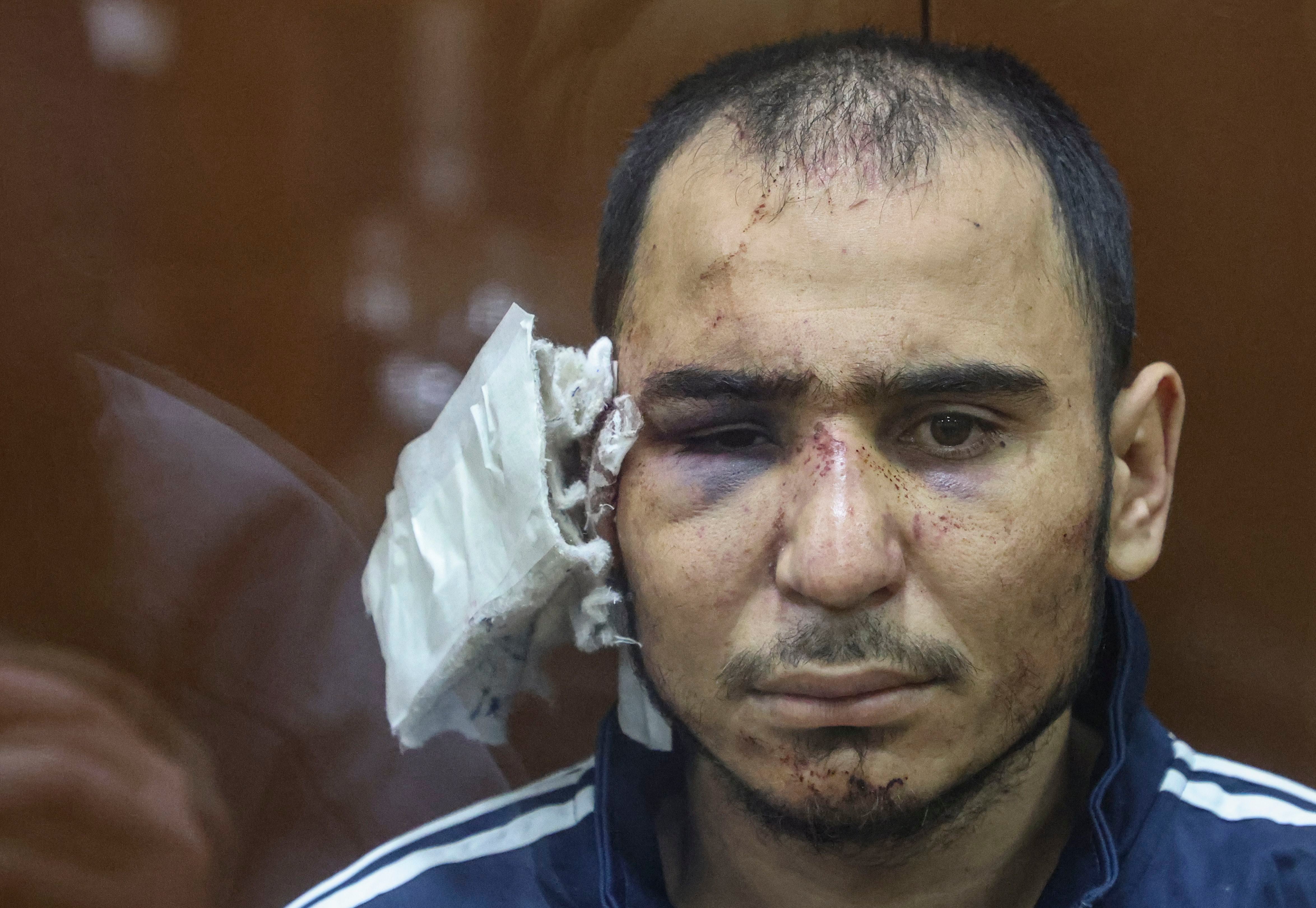 Saidakrami Murodali Rachabalizoda lleno de moratones y sin una oreja en una foto del 24 de marzo de 2024. (EFE/EPA/SERGEI ILNITSKY) 