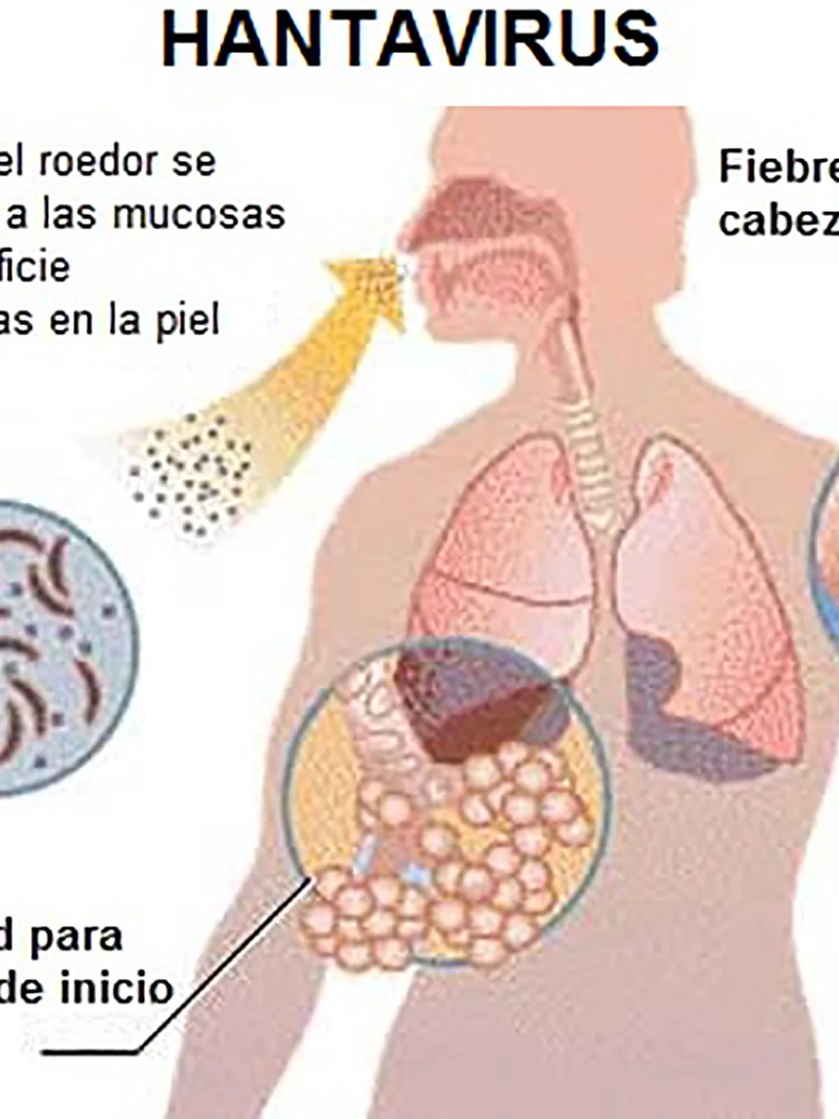 Hantavirus, qué es y cómo los roedores pueden contagiarte - Nocucas