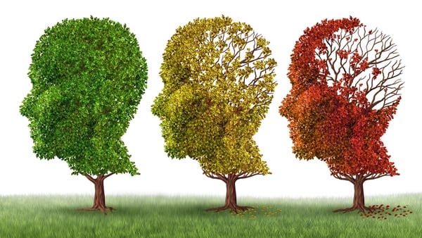El Alzheimer es la primera causa de demencia en el mundo (Shutterstock)