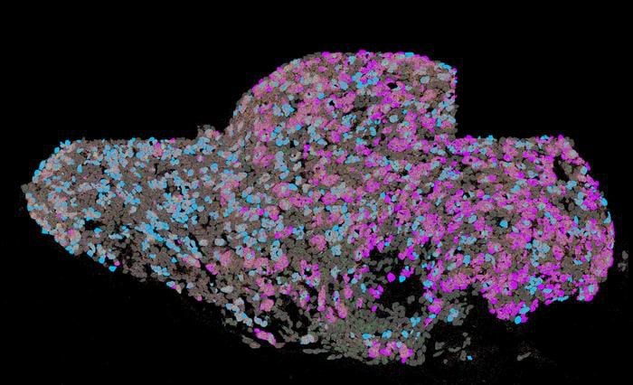El ganglio cervical superior de un ratón: aquí, las neuronas que controlan el músculo cardiaco (en color rosa) están muy cerca de las que controlan la glándula pineal (en azul). El estudio demostró que  los ganglios pueden actuar como "cajas de conmutación eléctrica" que conectan dos órganos/Karin Ziegler / TUM
