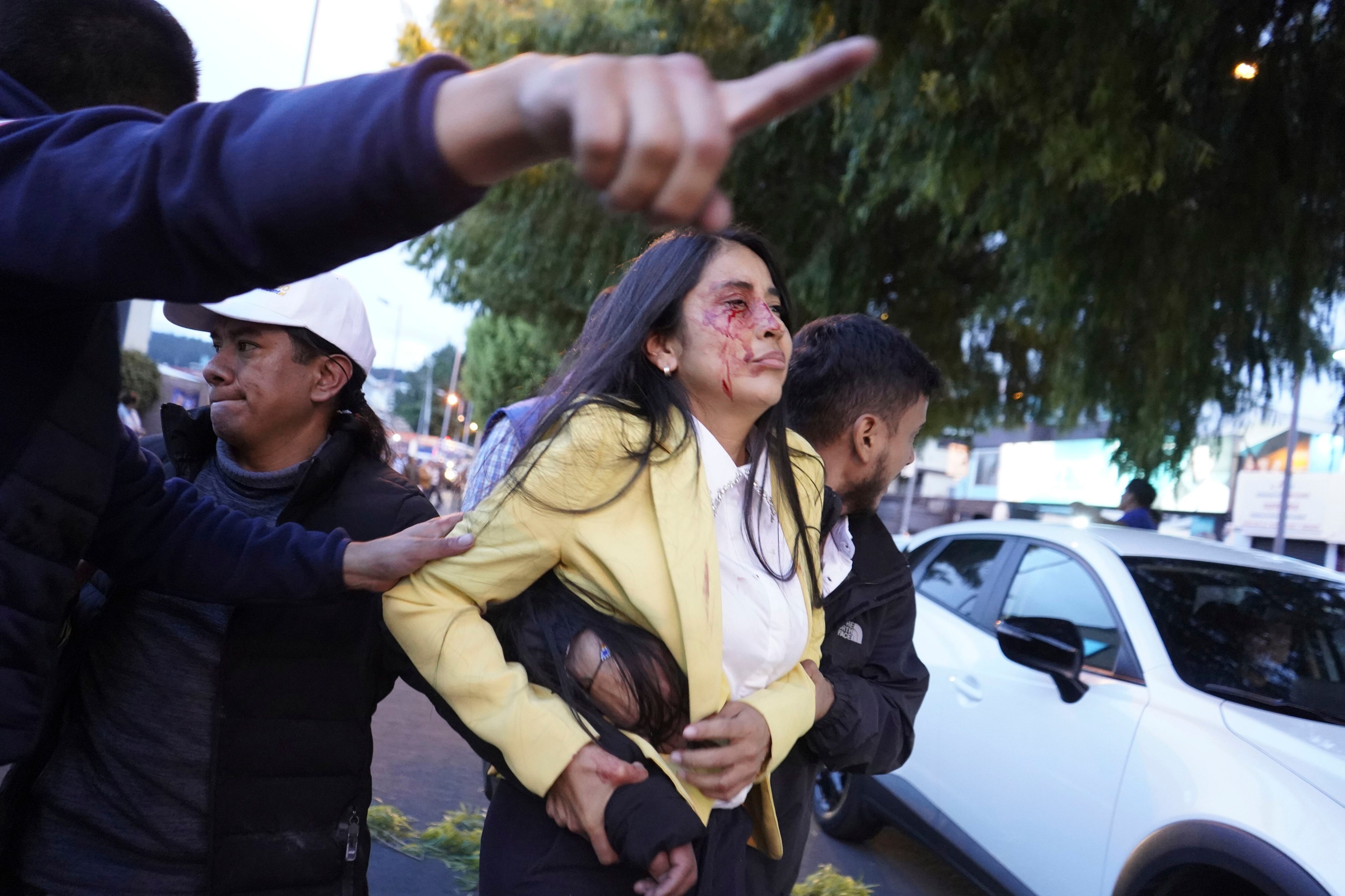 Una mujer ensangrentada es trasladada tras el ataque a tiros en el que el candidato presidencial Fernando Villavicencio fue asesinado en un acto de campaña a las afueras de un colegio en Quito, Ecuador, el miércoles 9 de agosto de 2023. (API vía AP)