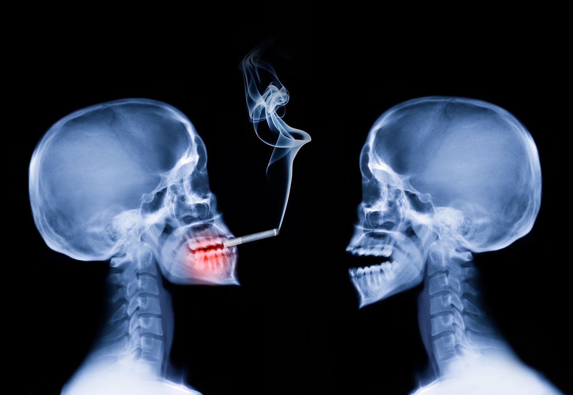 A pesar de las creencias populares, la exposición al humo de segunda mano es más común de lo que se piensa
(Getty Images)