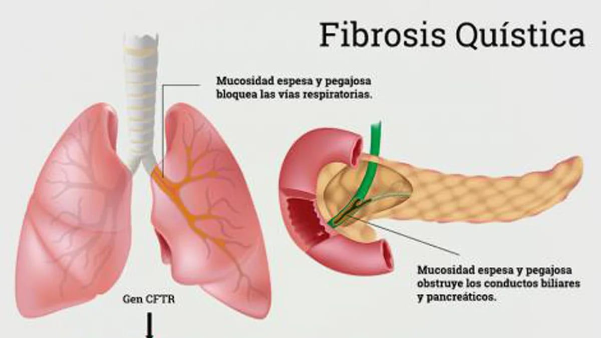 Mocos y flemas en bebés: cómo y cuándo tratarlos