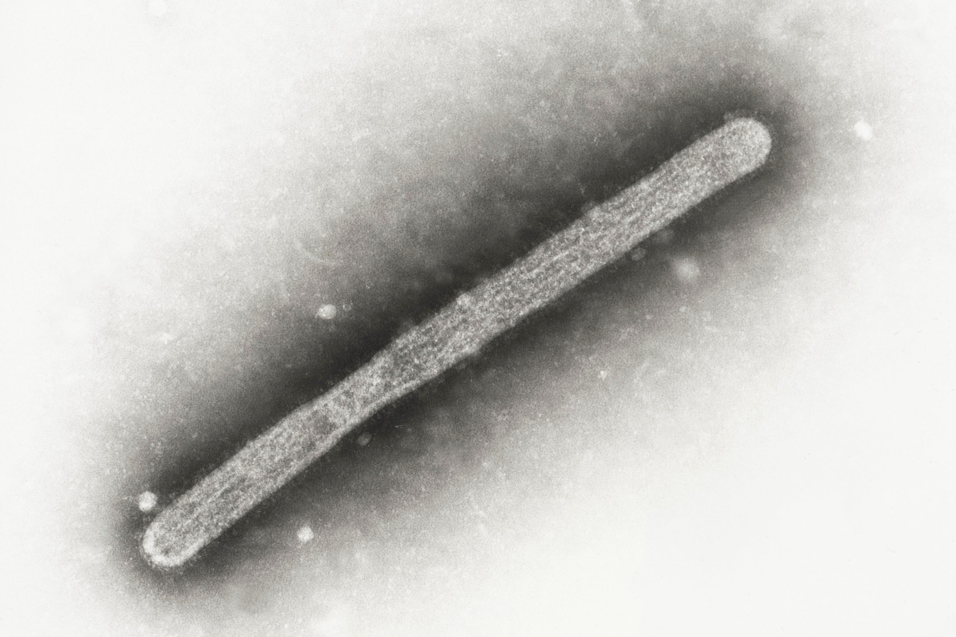 Esta imagen captada con un microscopio electrónico que muestra un virión de influenza aviar A H5N1. (Cynthia Goldsmith, Jackie Katz/CDC vía AP)