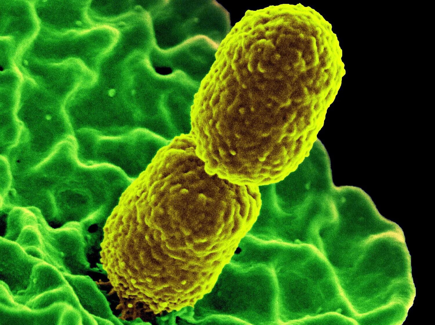 Se identificó que 33 bacterias, que producen infecciones en los seres humanos, son la segunda causa de muerte en todo el mundo (National Institute of Allergy and Infectious Diseases (NIAID)