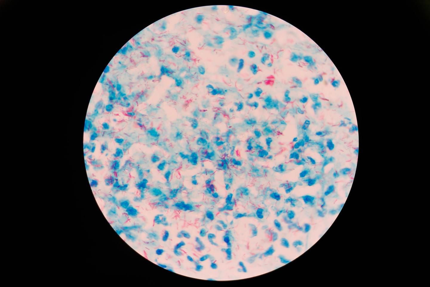 bacteria captura por Texas Biomedizinisches Forschungsinstitut