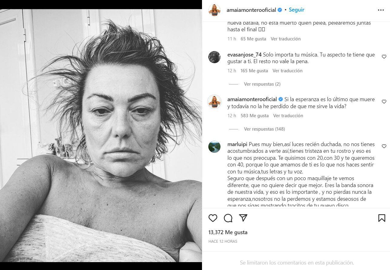 Amaia Montero preocupa en Instagram por su apariencia