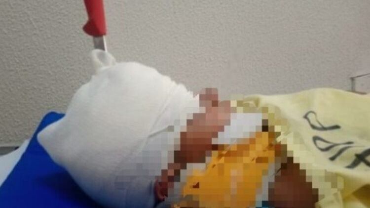 El menor fue hospitalizado y sometido a cirugía (Foto: Twitter/@opinion_sonora)