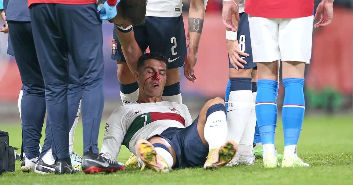 O golpe violento em Cristiano Ronaldo que assustou a todos no jogo República Checa-Portugal