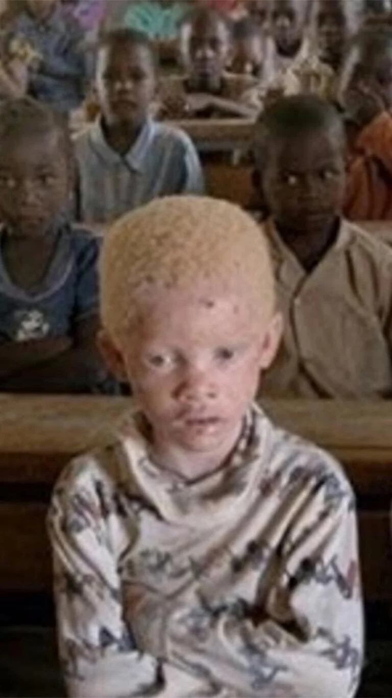 modelo albino africano