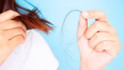 1 de cada 6 mujeres sufre de alopecia y sólo 4 de cada 10 consultan (Shutterstock)