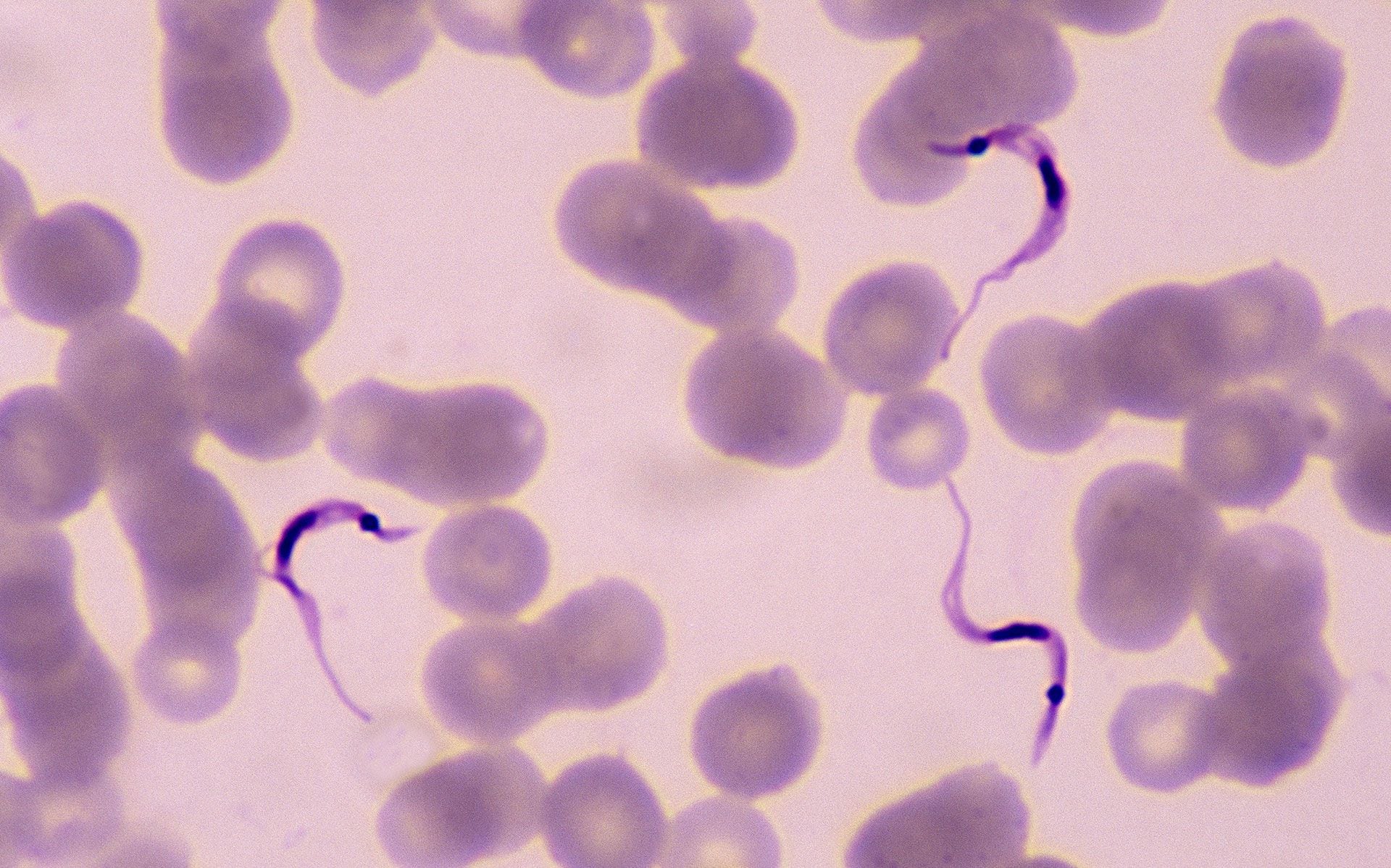 La OMS identifica a la tripanosomiasis americana como una de las enfermedades más descuidadas, con repercusiones devastadoras en regiones de Latinoamérica
(Crédito: Getty)