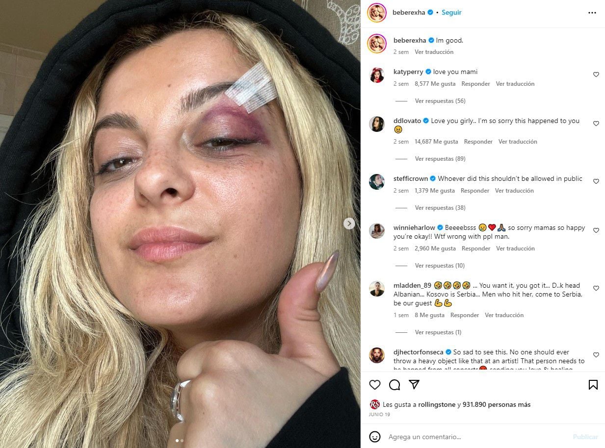 Bebe Rexha fue golpeada con un celular que le aventaron del público. El responsable fue arrestado
Foto: Instagram/Bebe Rexha