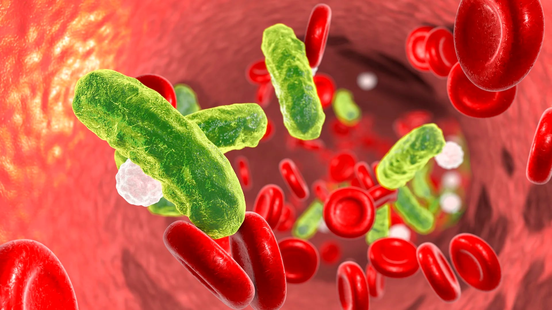 Las infecciones bacterianas pueden ser mortales. En 2019 produjeron la muerte de 7,7 millones personas en todo el mundo, según un estudio publicado en The Lancet (iStock)