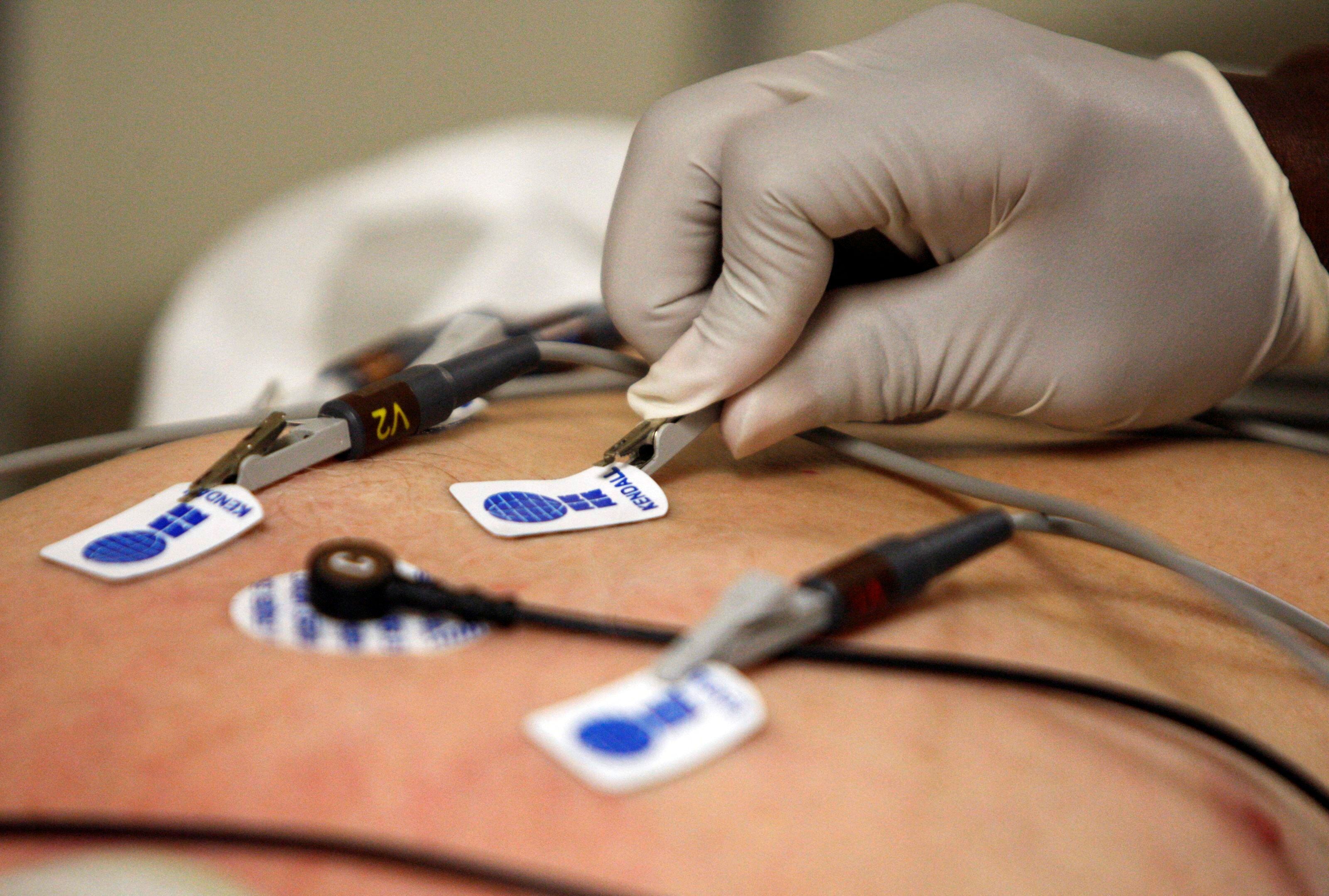 El electrocardiograma es el registro eléctrico de la actividad cardíaca desde la superficie corporal (REUTERS/Jessica Rinaldi/File Photo)