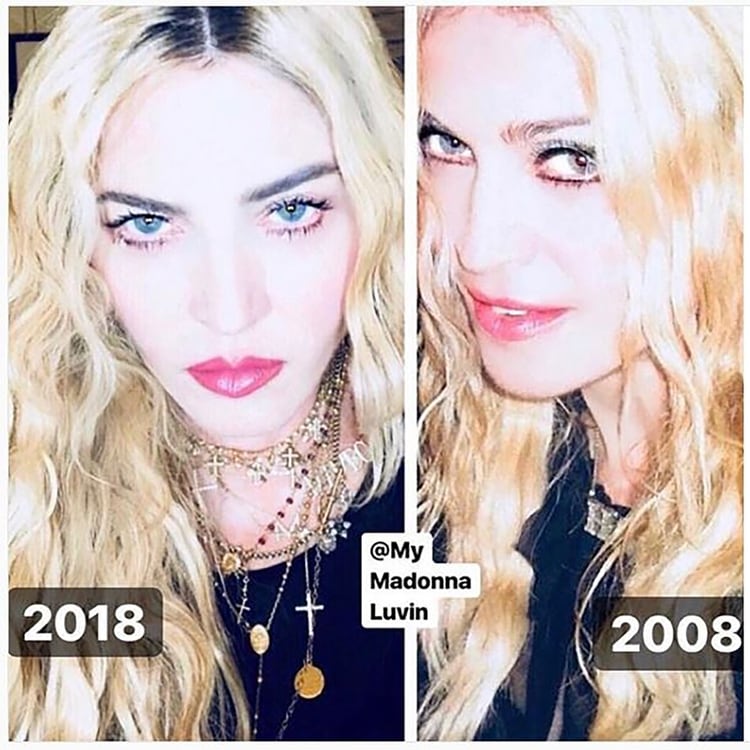 Madonna #10yearchallenge-(Instagram: Madonna)
