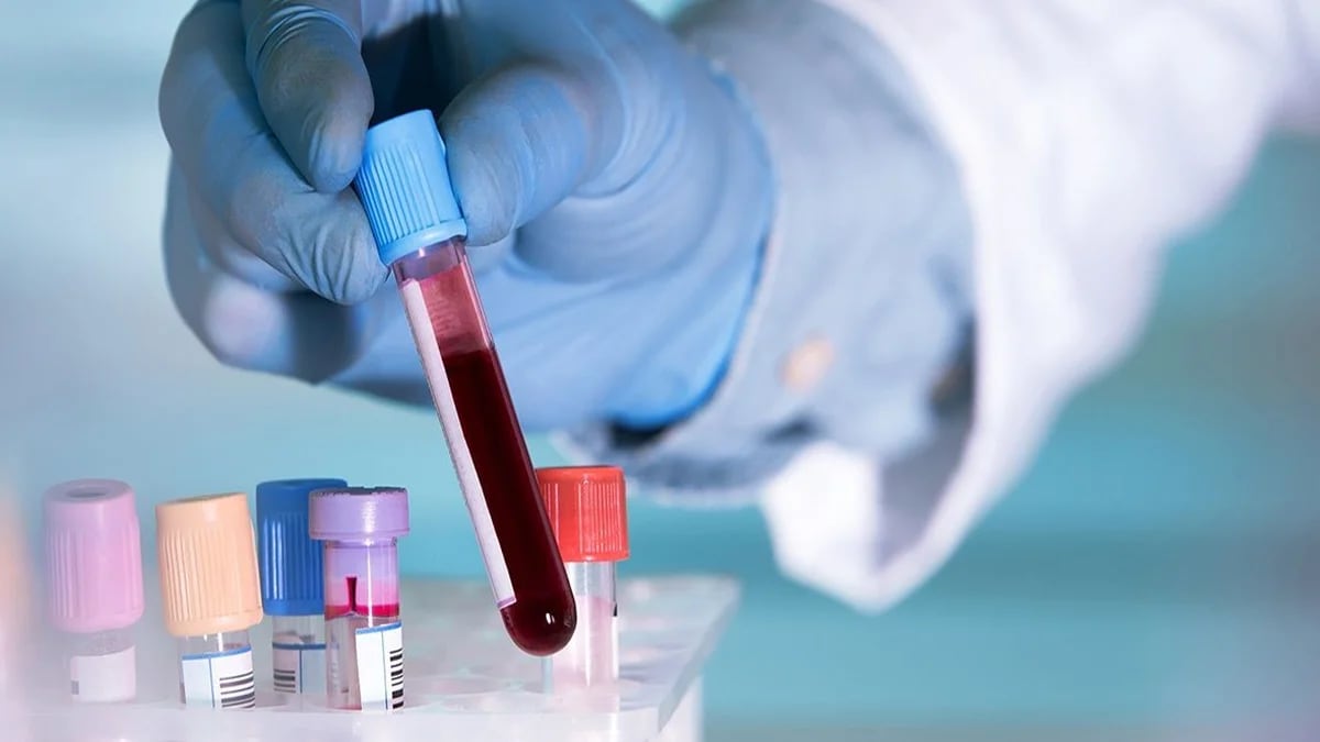 4 biomarcadores y un fármaco buscan redefinir el tratamiento de la  diabetes, según estudio de Harvard - Infobae