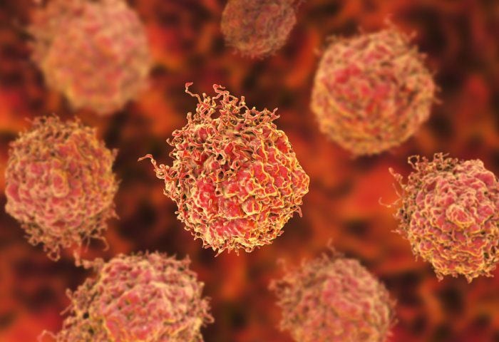 Prostate cancer cells (Photo: Imperial College London)