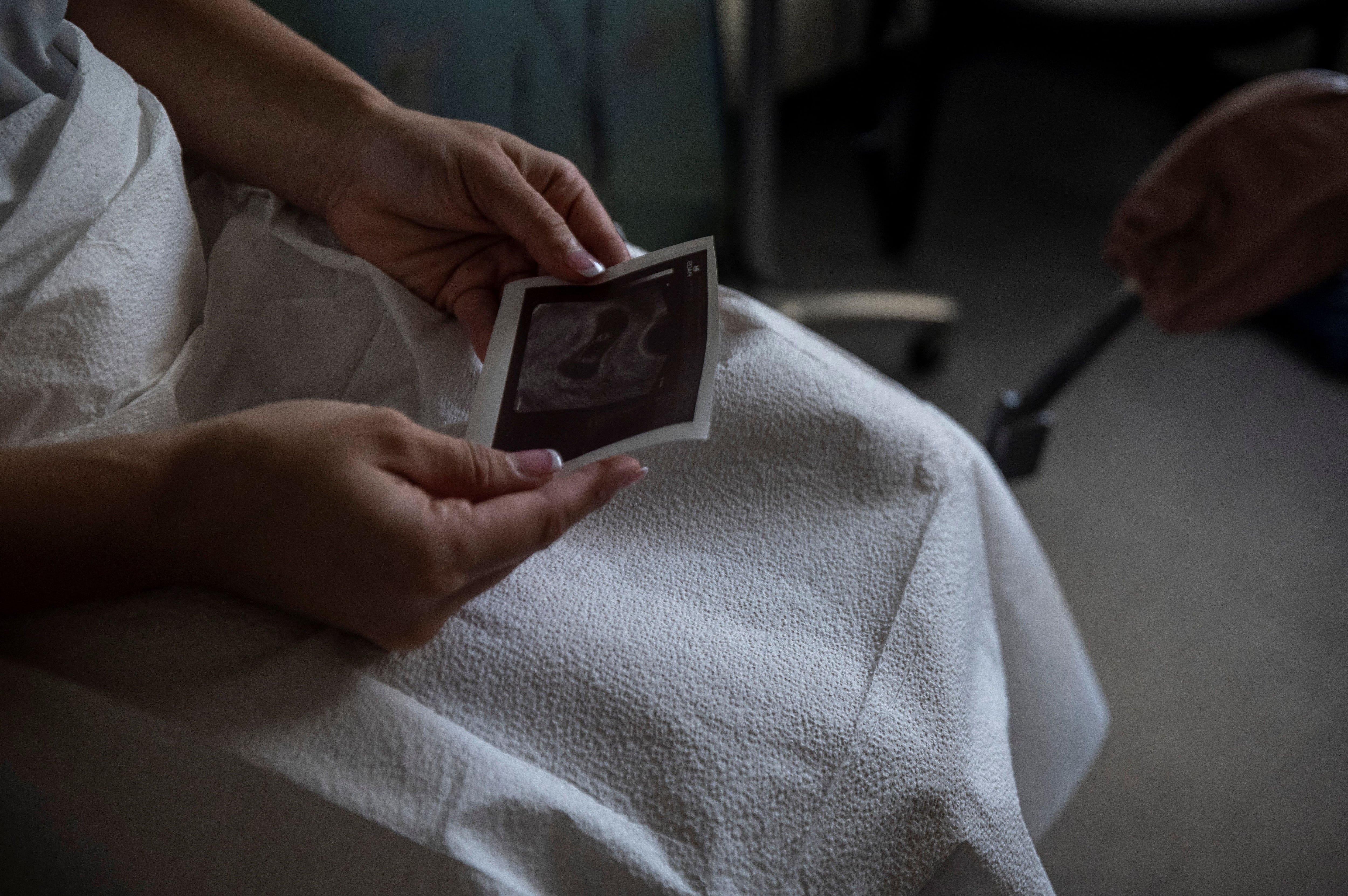 De 26 años y madre de cinco niñas, María vive en la pobreza extrema, alojada en casa de una amiga en un barrio popular de Caracas. (REUTERS)