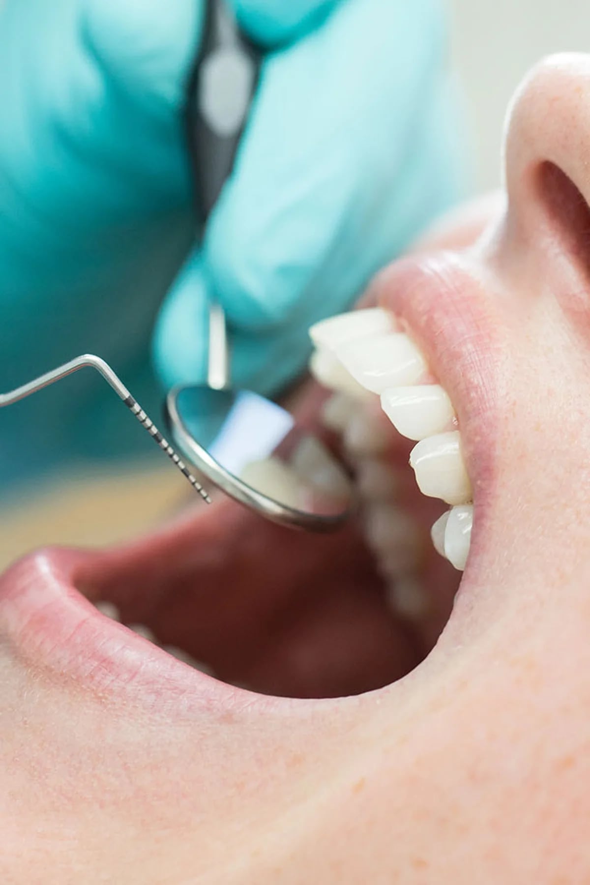 Los dentistas coinciden: esta es la forma correcta para limpiar y