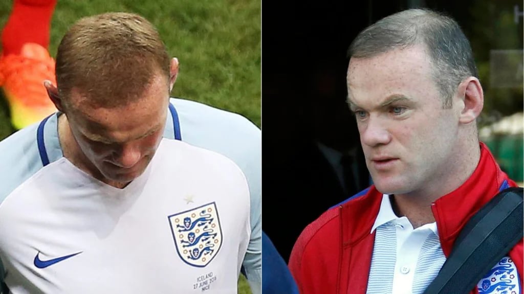 El cambio en la cabellera de Wayne Rooney es sorprendente (Reuters – EFE)