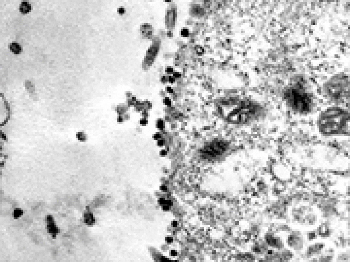 Científicos capturaron el momento exacto en el que el coronavirus infecta  una célula - Infobae
